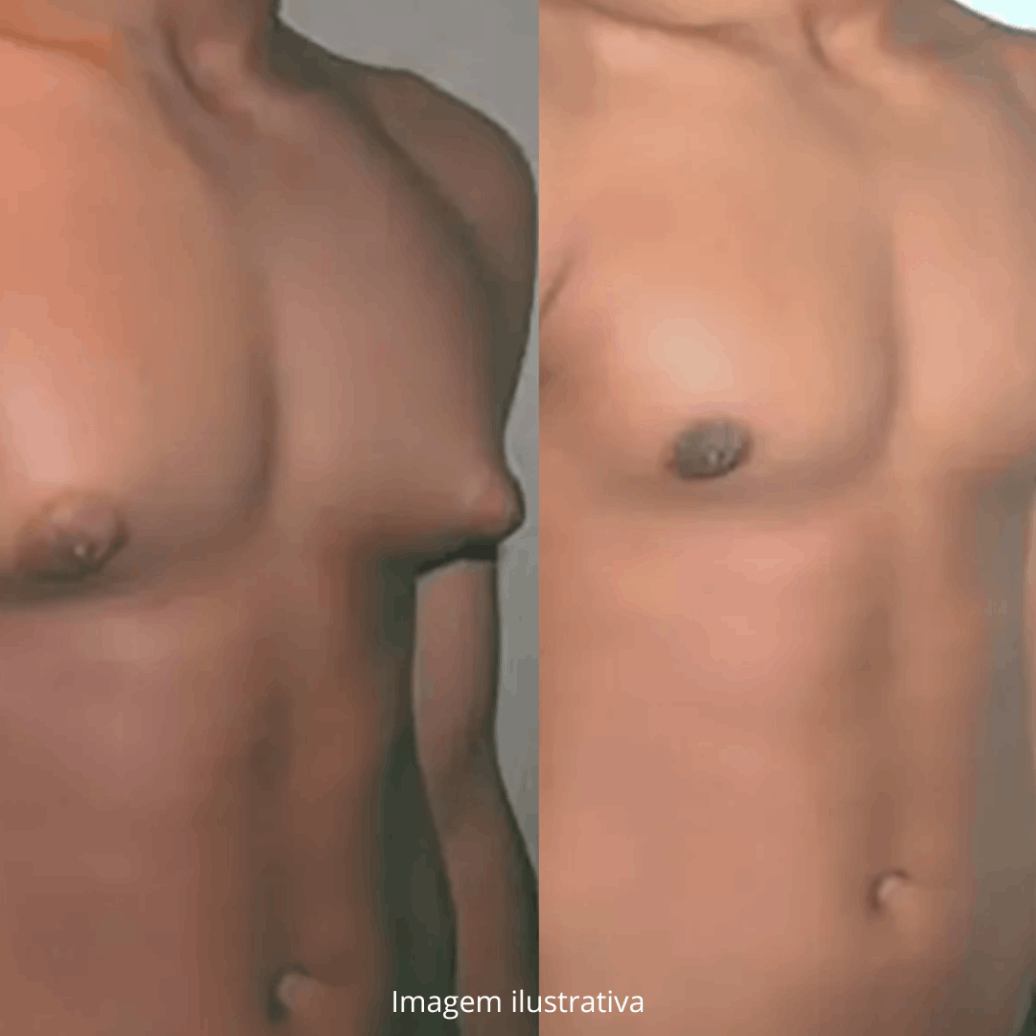 Clinica Cirurgião Médico Lipoaspiração São Paulo SP