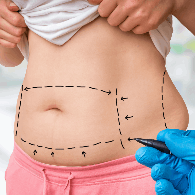 Cirurgião Estética Clínica Lipoaspiração São Paulo SP